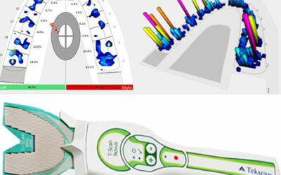 Análisis digital de la oclusión