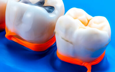 La importancia del aislamiento con dique de goma