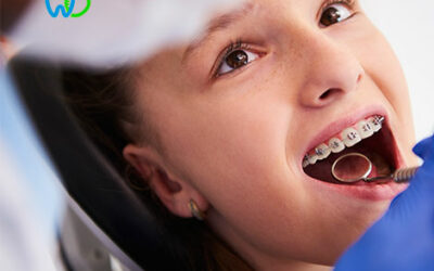 Ortodoncia Interceptiva