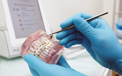 Tipos de ortodoncia ¿Qué tratamiento elegir?