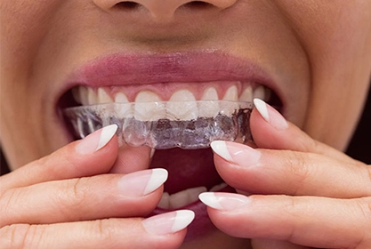 Domiciliario-con-férula-blanqueamiento2