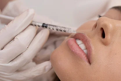 aumento_labios_acido_MD (1)