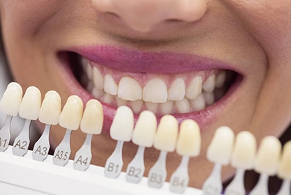 blanqueamiento-combinado