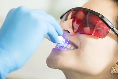 blanqueamiento-por-fotoactivación