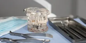 Implante dental unitario<br />
